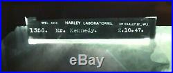John F Kennedy X Ray Signed Harley Laboratories London Dated 10-2 1947 With Coa