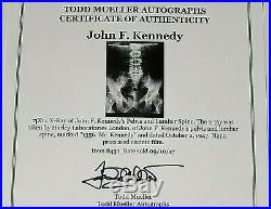John F Kennedy X Ray Signed Harley Laboratories London Dated 10-2 1947 With Coa